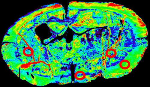 Image of mouse brain.