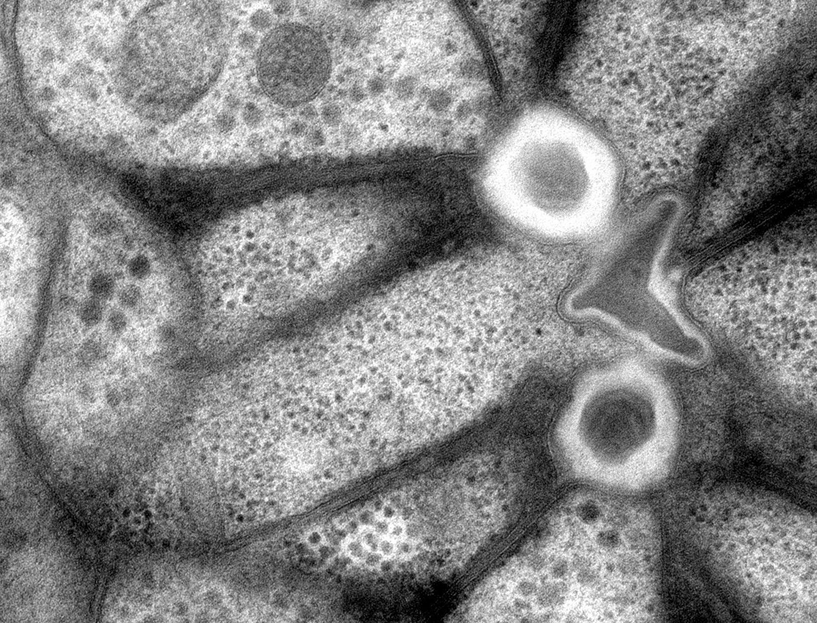 A reconstruction of the pharynx of a soybean cyst nematode juvenile.