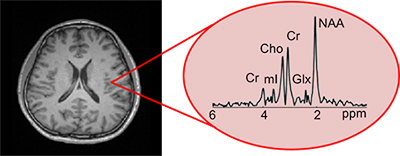 Shows data related to an MRI slice image of the brain.