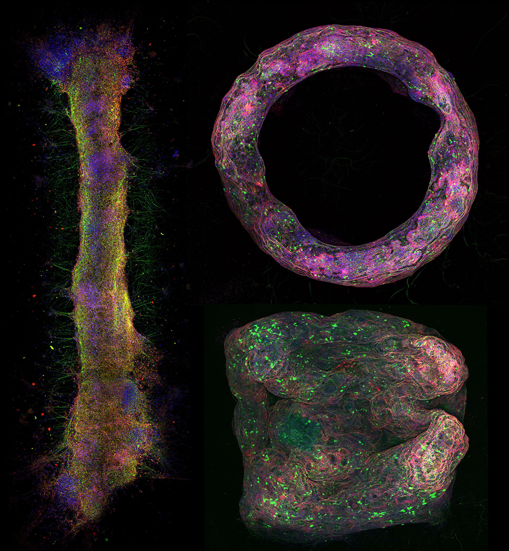 Different neural tissue geometries formed with the new biofabrication method and imaged using confocal microscopy.